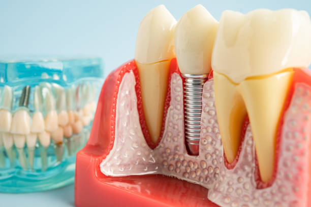 Best Periodontal (Gum) Disease Treatment  in Prospect, KY